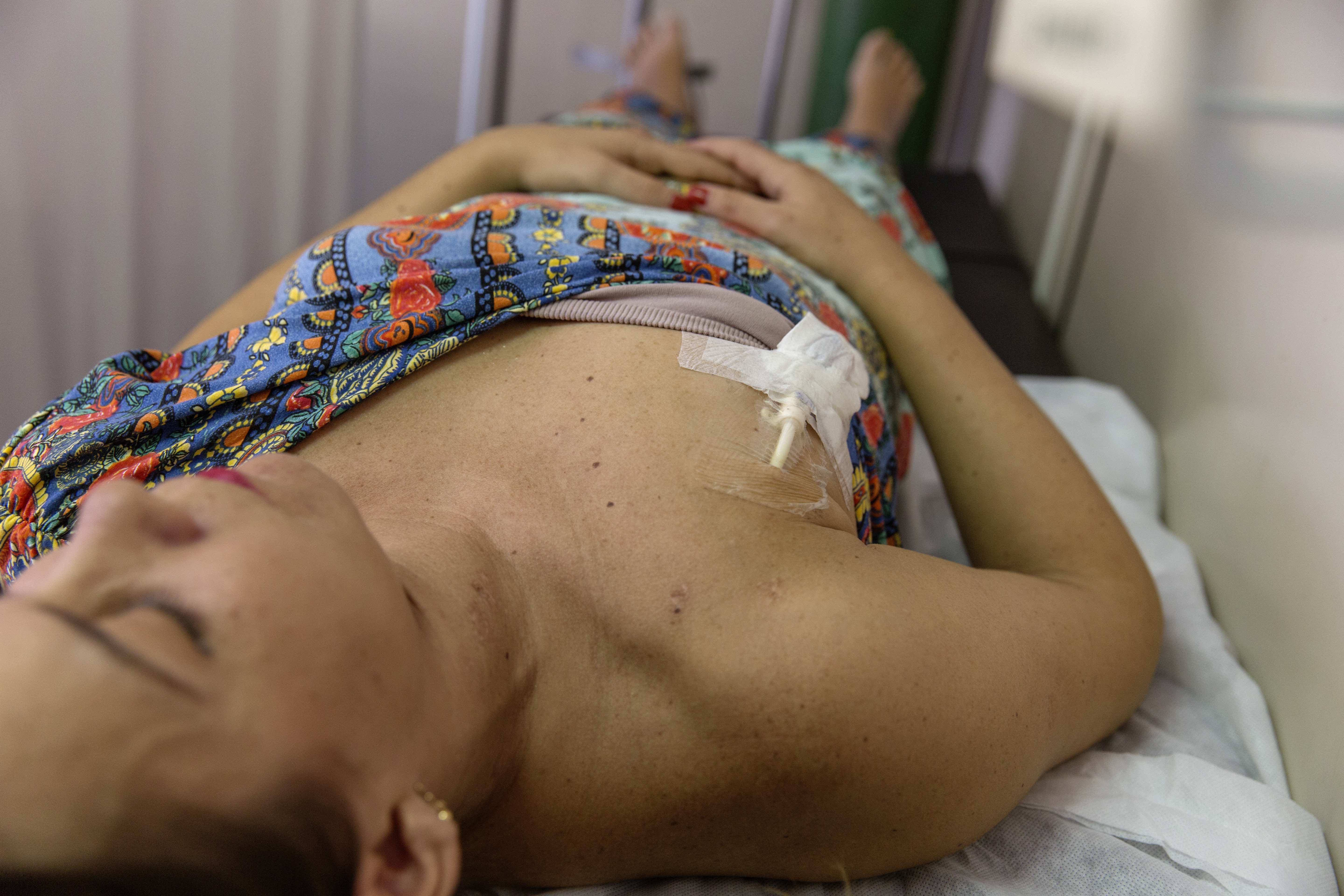 

<!-- THEME DEBUG -->
<!-- THEME HOOK: 'field' -->
<!-- FILE NAME SUGGESTIONS:
   ▪️ field--node--title--pin.html.twig
   ✅ field--node--title.html.twig
   ▪️ field--node--pin.html.twig
   ▪️ field--title.html.twig
   ▪️ field--string.html.twig
   ▪️ field.html.twig
-->
<!-- 💡 BEGIN CUSTOM TEMPLATE OUTPUT from 'themes/custom/whokap/templates/field/field--node--title.html.twig' -->
Epidemic of Chronic Kidney Disease in Agricultural Communities in Central America: Case definitions, methodological basis and approaches for public health surveillance
<!-- END CUSTOM TEMPLATE OUTPUT from 'themes/custom/whokap/templates/field/field--node--title.html.twig' -->

