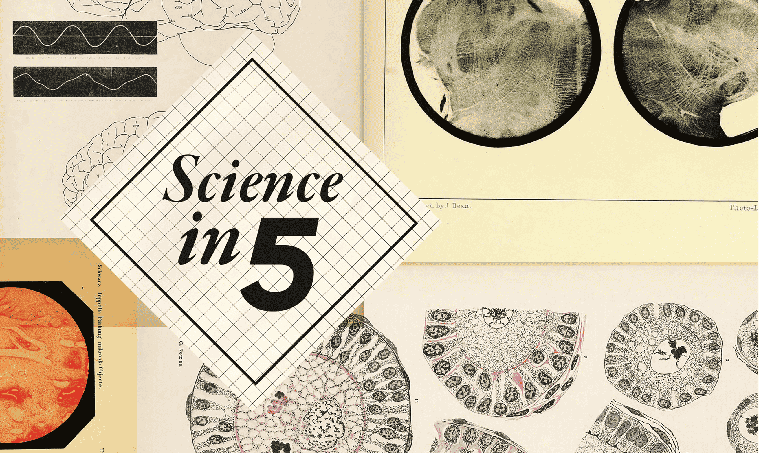 

<!-- THEME DEBUG -->
<!-- THEME HOOK: 'field' -->
<!-- FILE NAME SUGGESTIONS:
   ▪️ field--node--title--pin.html.twig
   ✅ field--node--title.html.twig
   ▪️ field--node--pin.html.twig
   ▪️ field--title.html.twig
   ▪️ field--string.html.twig
   ▪️ field.html.twig
-->
<!-- 💡 BEGIN CUSTOM TEMPLATE OUTPUT from 'themes/custom/whokap/templates/field/field--node--title.html.twig' -->
Science in 5: Breast cancer: Take charge of your health
<!-- END CUSTOM TEMPLATE OUTPUT from 'themes/custom/whokap/templates/field/field--node--title.html.twig' -->

